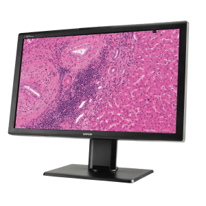 DP MONITOR